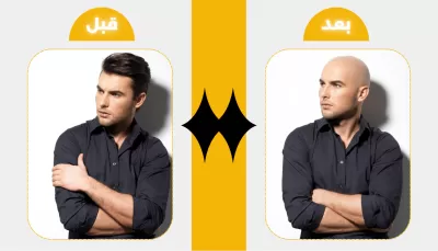 تعديل الصور بالفوتوشوب بشكل احترافي فقط